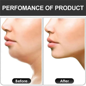 Wholesale Jaw <b>Exerciser</b> Neck Toning <b>Face</b> Muscle Trainer V Shape FaceShape Fitness Double Chin Reducer Two Resistance Levels - Product Image 5