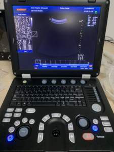 Portátil portátil Color Ultrasonido Escáner Máquina 3D Notebook tipo ultrasonido - Product Image 4