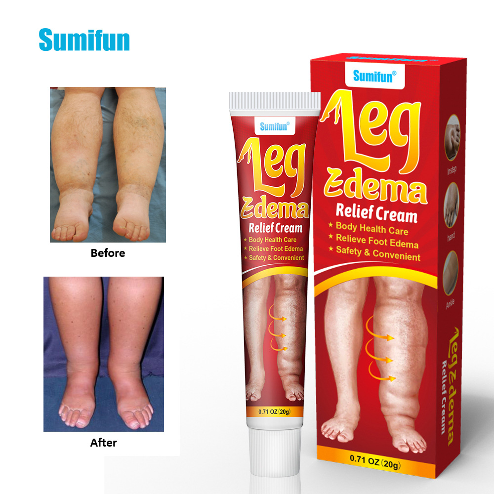 Body Health Care Ointment for Eliminate Edema 20g Natural Herbal Eliminate Swelling Cream