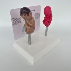 Comparaison des sciences médicales Modèle de maladie de pathologie de malformation fœtale humaine Modèle de maladie d'organe Modèle anti-drogue - Product Image 2