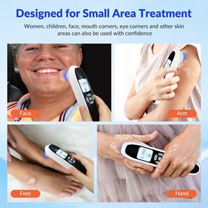 เครื่องรักษา<span class=keywords><strong>โรค</strong></span>สะเก็ดเงิน <span class=keywords><strong>โรค</strong></span>ด่างขาว <span class=keywords><strong>โรค</strong></span>ผิวหนังอักเสบ <span class=keywords><strong>โรค</strong></span>กลาก ใช้ในทางการแพทย์ รุ่นใหม่ ใช้กับหลอดเอ็กไซเมอร์ 308 นาโนเมตร สำหรับใช้ส่วนตัว พร้อมอิมัลชั่นยูวีสำหรับไดโอดแสง - Product Image 2