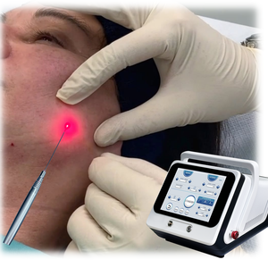 Liposuccion laser à double onde de lipolyse laser CE 980nm 1470nm Endolaser efficace pour la perte de graisse au laser <span class=keywords><strong>Endo</strong></span> Minimalement chirurgical - Product Image 1