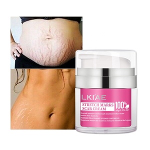 Mới thai sản chăm sóc da loại bỏ mang thai slack chống stretchmark sẹo sửa chữa cơ thể vết rạn da và sẹo Remover Kem - Product Image 1