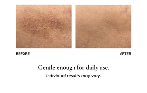 Balsem Herbal Tallow Label Pribadi untuk Eksim, Krim Balsem Tubuh Madu Tallow Alami untuk <span class=keywords><strong>Psoriasis</strong></span> dan Eksim - Product Image 4