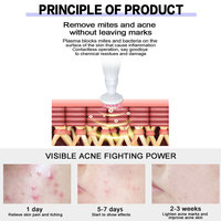 Stylo à plasma oxygène portatif pour le traitement de l'acné du visage, nettoyage, lifting cutané, stylo à plasma froid à l'ozone