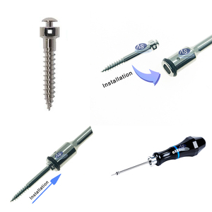 Nuova vite ortodontica dentale Micro accessori impianto endosseo - Product Image 3