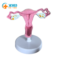 Modelo Anatómico de Útero y Ovario Femenino de Tamaño Real, Modelo de Órgano Reproductivo Humano con Base para Enseñanza Médica en Ginecología