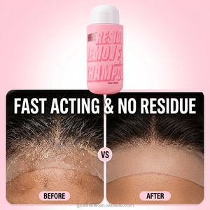 Gel Dissolvant Professionnel 2-en-1 pour Colle de <span class=keywords><strong>Perruque</strong></span>, Sans Résidu, à l'Huile d'<span class=keywords><strong>Arbre</strong></span> à Thé, Solvant pour Colle Lace Front, Nettoyant pour Systèmes Capillaires – Vente en Gros - Product Image 3