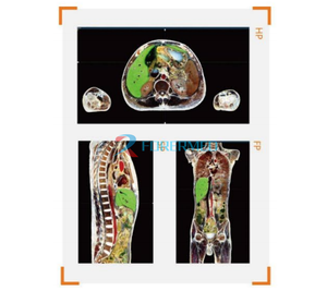 Tavolo di Dissezione Virtuale 3D per l'Insegnamento Medico del Corpo Umano, per Studi Universitari e Universitari - Product Image 6