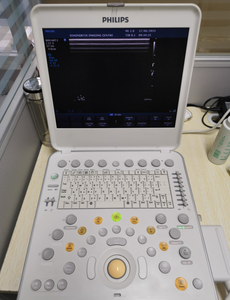 Fourniture et réparation de la machine à ultrasons portable CX50 - Product Image 2