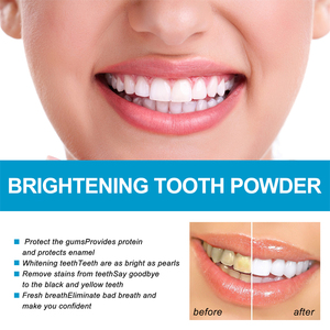 Poudre blanchissante pour les dents West Month au bicarbonate <span class=keywords><strong>de</strong></span> <span class=keywords><strong>soude</strong></span>, élimination des taches, éclaircissement, protection des gencives, élimination <span class=keywords><strong>de</strong></span> la mauvaise haleine - Product Image 4