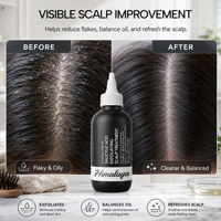 Serum Kulit Kepala AHA Profesional, Eksfolian Kimia untuk Perawatan Akar Rambut Kulit Kepala Berminyak dan Tersumbat, Label Pribadi Grosir