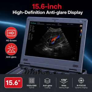 Système d'échographie Doppler couleur portable professionnel médical numérique C6pro-02 Advanced Trueview - Product Image 5