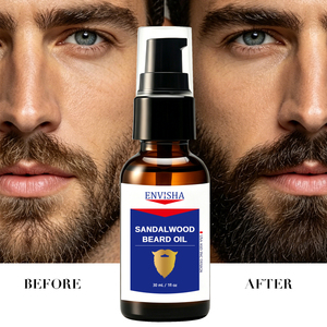 Produits <span class=keywords><strong>de</strong></span> croissance <span class=keywords><strong>de</strong></span> <span class=keywords><strong>la</strong></span> <span class=keywords><strong>barbe</strong></span> 100% naturels en gros, soins <span class=keywords><strong>pour</strong></span> hommes, huile d'argan, huile <span class=keywords><strong>de</strong></span> jojoba, soins quotidiens <span class=keywords><strong>de</strong></span> <span class=keywords><strong>la</strong></span> <span class=keywords><strong>barbe</strong></span> <span class=keywords><strong>pour</strong></span> hommes, huile <span class=keywords><strong>de</strong></span> <span class=keywords><strong>barbe</strong></span> au bois <span class=keywords><strong>de</strong></span> santal - Product Image 2