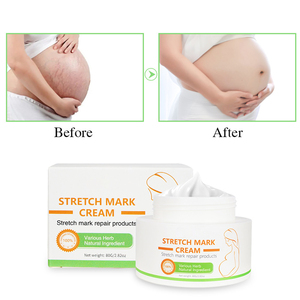 Marque privée Crème <span class=keywords><strong>anti</strong></span>-vergetures naturelle efficace <span class=keywords><strong>anti</strong></span>-acné bio pour la réparation de la peau Crème <span class=keywords><strong>anti</strong></span>-vergetures pour la <span class=keywords><strong>grossesse</strong></span> et le retrait des cicatrices - Product Image 2