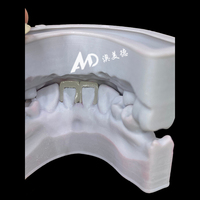 Veneers en porcelaine dentaire pour cliniques et laboratoires dentaires |   Placages en stratifié E.max sur mesure ultra-fins OEM/ODM pour un sourire éclatant