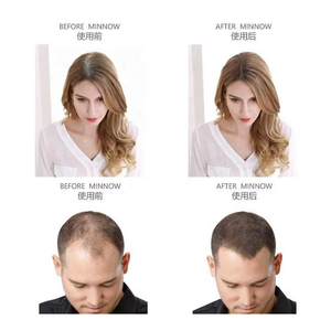 Phụ Nữ 27.5G Keratin Tóc Sợi Bột Người Đàn Ông Dày Điều Trị Tóc Xây Dựng Sợi Bột - Product Image 2