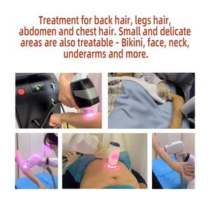 Appareil d'épilation au laser à diode, machine à laser pour le type de peau I II III <span class=keywords><strong>IV</strong></span> V VI, épilation au laser, spa, salon, clinique, hôpital, équipement de beauté médicale - Product Image 6