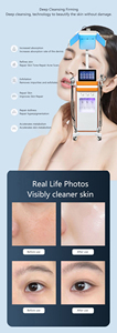 Sistema Facial Multifuncional Profesional con H2O2 Hydra Machine - Nuevo Diseño de Alta Eficiencia para Limpieza y Oxigenación, Innovación en Belleza - Product Image 6