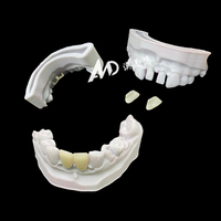 Veneers en porcelaine dentaire pour cliniques et laboratoires dentaires |   Placages en stratifié E.max sur mesure ultra-fins OEM/ODM pour un sourire éclatant
