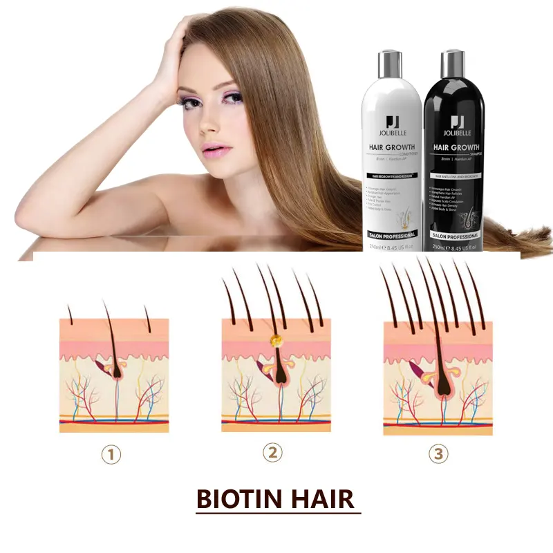 Champú y acondicionador para el crecimiento del cabello, marca privada que fortalece la densidad, biotina orgánica, anticaída