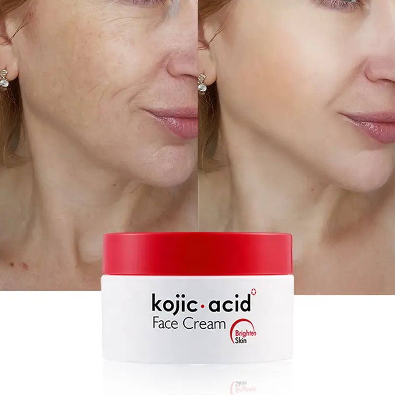 7 Dias Clareamento Creme Facial Kojic Ácido Mancha Escura Creme Clareamento Dia e Noite Creme Facial Ácido Kojic