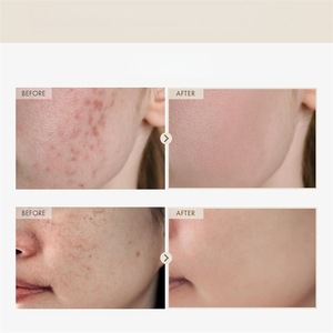 Kore OEM Yüz Serumu %10 <span class=keywords><strong>Niacinamide</strong></span> + %4 TXA + Vitamin B5 Karanlık Leke Düzeltici Parlatıcı Sıvı Arbutin Deniz Yosunu Astaksantin - Product Image 4