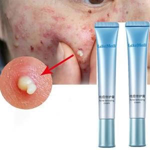 Crème réparatrice anti-acné professionnelle OEM 50g, crème <span class=keywords><strong>de</strong></span> soin <span class=keywords><strong>de</strong></span> la <span class=keywords><strong>peau</strong></span> pour peaux sujettes à l'acné, crème intensive pour peaux à tendance acnéique - Product Image 2