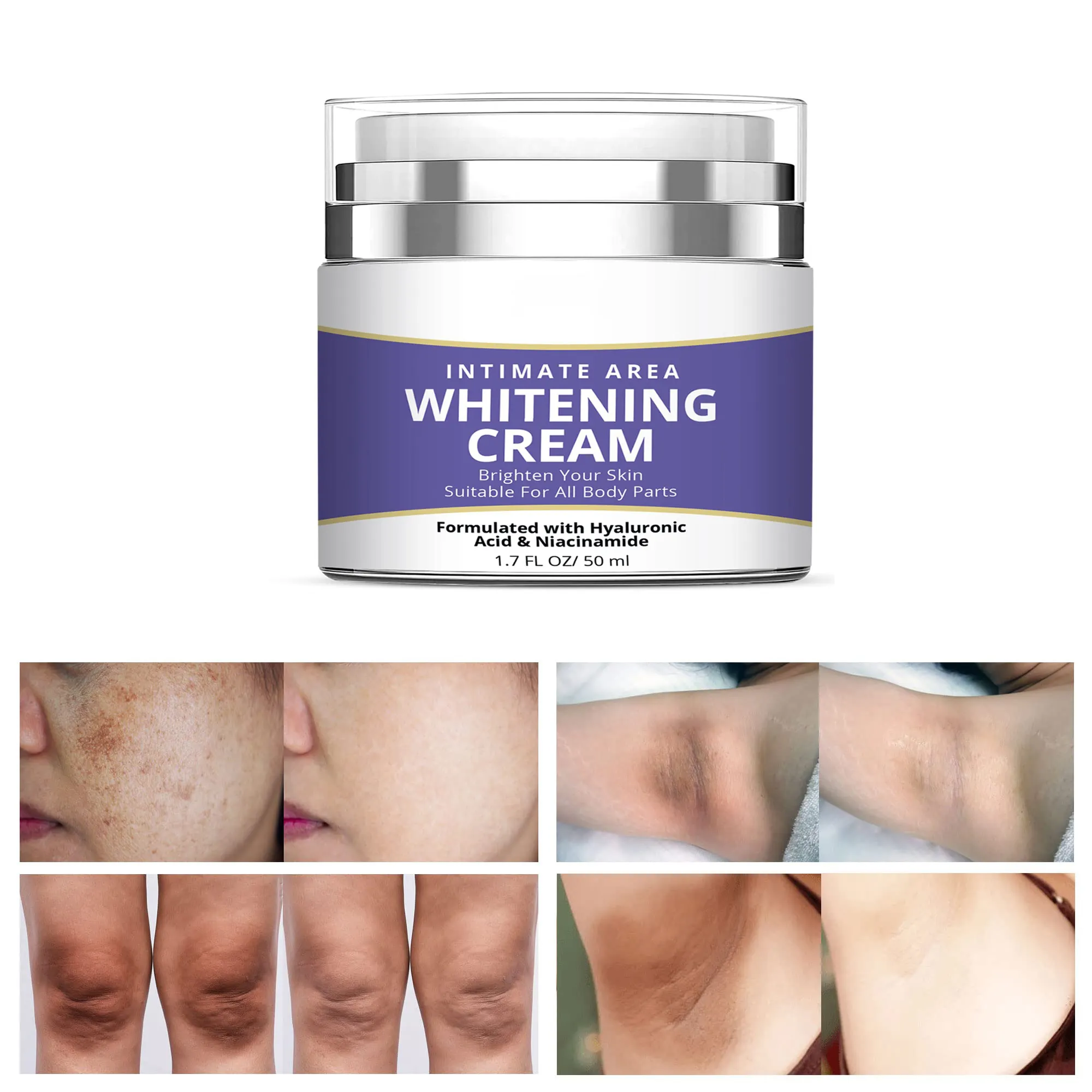 Gezicht Donkere Vlek Corrector Lichaam Onderarm Knieën Ellebogen Oksel Beste Verhelderende Pigment Huid Whitening Crème