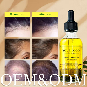 Suero para el Crecimiento del Cabello a Base <span class=keywords><strong>de</strong></span> Hierbas OEM ODM, Etiqueta Privada, Aceite <span class=keywords><strong>de</strong></span> Argán y Ácido Hialurónico - Product Image 1