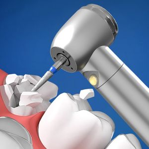 Tandheelkundige Hoge Snelheid Standaard Hoofd Lucht Turbine 3 Punts Water Spray Led Licht Tandheelkundig Handstuk 2 Of 4 Gat Drukknop - Product Image 5