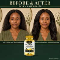 BIYODE Africa : Gélules de Vitamine E 1000 UI à forte concentration, Complément de bien-être, En stock, Faible MOQ, Vente en gros directe usine