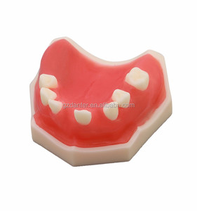 Modello mandibolare dentale in resina Danter con osso cancelloso 6x7x3cm modello A2028 per la pratica dell'impianto nella scienza medica - Product Image 4