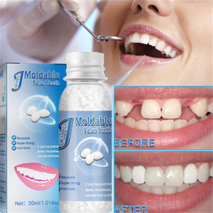 Nuovo Gel per Denti Finti OEM, Utilizzabile per Riempire o Riparare Temporaneamente Denti Mancanti e Rotti, Denti Finti Modellabili - Product Image 6