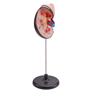 Modelo biológico de tamaño natural, modelo de enseñanza de riñón humano, modelo de riñón de una parte - Product Image 2