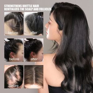Huile essentielle pour cheveux denses <span class=keywords><strong>West</strong></span> Month, huile essentielle pour réparer les cheveux abîmés, huile essentielle anti-chute - Product Image 4