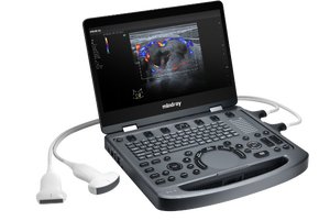 Ecógrafo Veterinario Digital Mindray MX6 con Doppler Color 3D 4D, Precio Competitivo para Uso Veterinario - Product Image 3