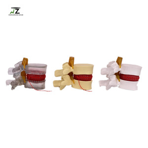 Lumbar Spine Model Intervertebral Disc Model Diseased Lumbar Spine Model - Product Image 2