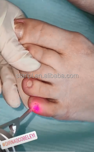 Classe IV Podologie Diode Laser 980nm Nail Fungus/Fascitis Plantaire/Pied <span class=keywords><strong>Verrues</strong></span> Podologie Onychomycose Thérapie - Product Image 6