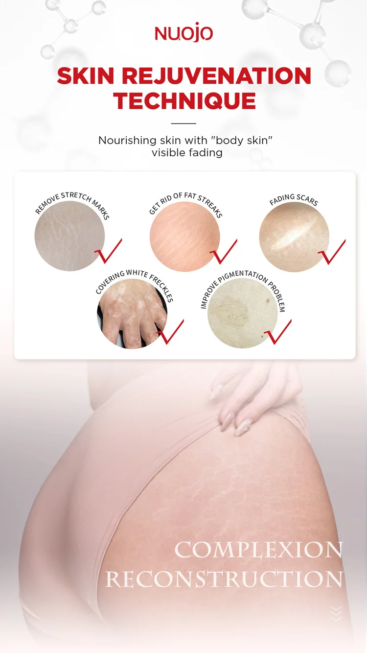Το μόνιμο δέρμα NUOJO που αναδιαμορφώνει τα σημάδια τεχνολογίας αφαιρεί τη χρωστική ουσία μηχανών Vitiligo μελανιού δερματοστιξιών σημαδιών τεντωμάτων