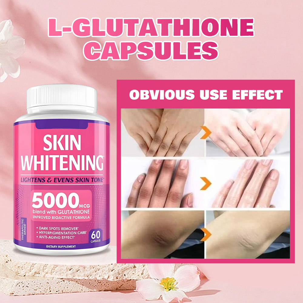 Fairir Glutathione 5000mcg Skin Whitening Capsules, Dark Spot Remover &  Anti-Aging Supplement| Alibaba.com