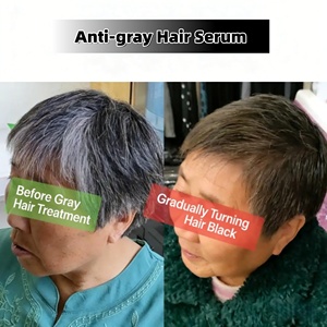 ผงสมุนไพรบำรุงหนังศีรษะ OEM ป้องกันผมหงอก บำรุงเส้นผม ลดการเกิดผมหงอกเป็นธรรมชาติ ช่วยฟื้นฟู<span class=keywords><strong>ผม</strong></span>ขาวให้กลับมาดำ - Product Image 3