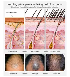 LANBENA Serum perawatan penumbuh rambut Thailand Serum pertumbuhan kembali Rambut Serum Kulit Kepala semprotan Losion penguat pertumbuhan rambut