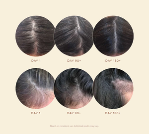 เซรั่มปิดผมขาวสูตรเฉพาะ ปราศจากส่วนผสมจากสัตว์ สารสกัดจากสมุนไพรธรรมชาติ ฟื้นฟูสี<span class=keywords><strong>ผม</strong></span> ลดการเกิดผมขาวใหม่ - Product Image 2