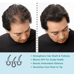 Aura DHT Blocker, Suplementos para el Crecimiento del Cabello para Hombres, Cápsulas de Extracto de Plantas Naturales, Nutracéuticos para Fortalecer el Cabello, Crecimiento del Cabello Masculino - Product Image 2
