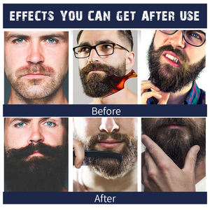 100% Tinh Khiết Tự Nhiên Biểu Tượng Tùy Chỉnh Bán Buôn Râu Chăm Sóc Thiết Yếu Ban Đầu Nhãn Hiệu Riêng Râu Hữu Cơ Râu Dầu Tăng Trưởng Cho Nam Giới - Product Image 3