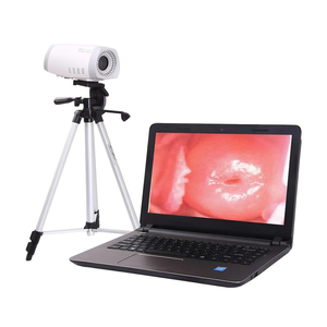 Colposcope numérique pour gynécologie, caméra électronique de colposcopie vidéo pour <span class=keywords><strong>vagin</strong></span> - Product Image 1