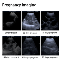 Échographe vétérinaire portable pour la détection de la gestation en ferme en extérieur et le diagnostic mobile
