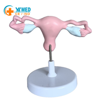 Modelo Anatómico de Útero y Ovario Femenino de Tamaño Real, Modelo de Órgano Reproductivo Humano con Base para Enseñanza Médica en Ginecología