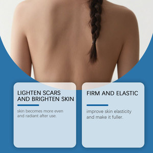 Nuevo Gel para <span class=keywords><strong>Eliminar</strong></span> Cicatrices a Bajo <span class=keywords><strong>Precio</strong></span> y de Alta Demanda, Adecuado para Situaciones como Marcas y <span class=keywords><strong>Estrías</strong></span> Durante el Embarazo. - Product Image 4